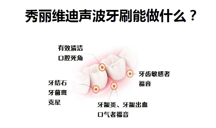 秀麗維迪聲波牙刷（感應(yīng)式/干電池）成人聲波牙刷、兒童聲波牙刷